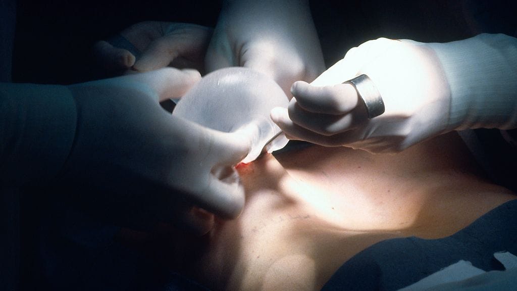 Rintaimplanttia asetetaan paikalleen.