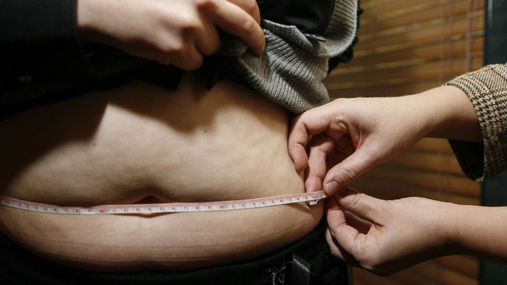 Nykyään joka kahdeksas aikuinen on merkittävästi ylipainoinen. Kuvituskuva.