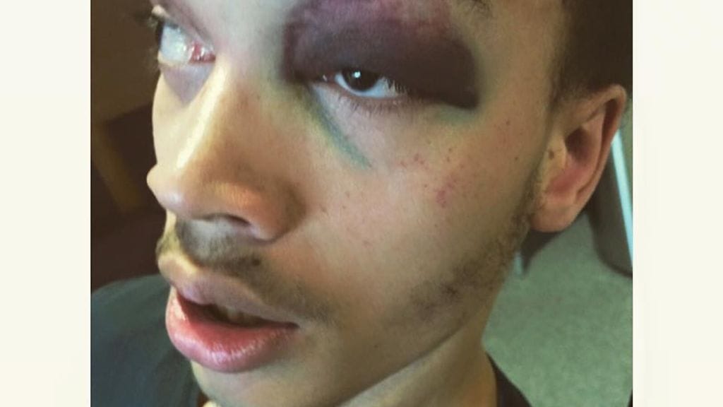 Patric hakattiin pahoin Kaarinassa.