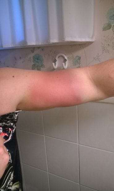 Joonas Mäkipelto, hauis