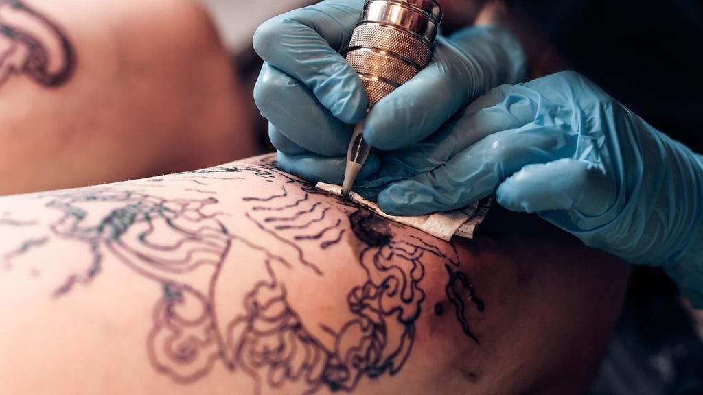 Viidentoista vuoden aikana mustepigmentti oli kulkeutunut naisen selästä käsivarteen.