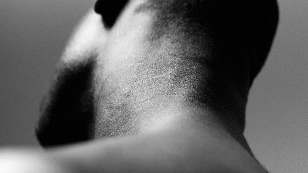 Suomessa lienee vuosittain muutamia melanoomaan sairastuvia ihmisiä, joiden iholla ei näy syöpään viittaavia muutoksia. Kuvituskuva.