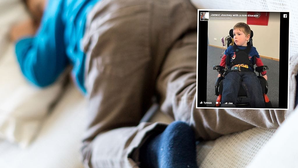 Viisivuotias James on menettänyt kokonaan liikuntaykykynsä.