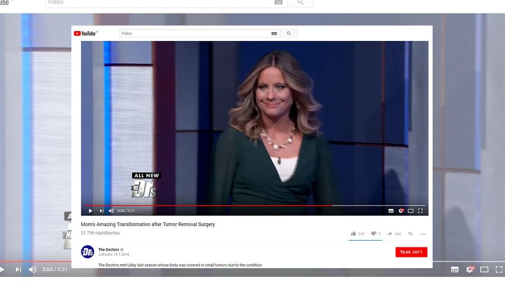 Libby Hufferin kehoa peittävät tuhannet kasvaimet, joista osa poistettiin leikkauksella. Kuvan lähde Youtube