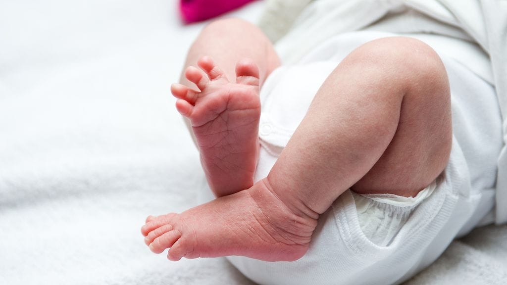 Filippiiniläisellä vauvalla on erittäin harvinainen vaiva, joka on saanut hänen päähänsä kasvamaan suuren sarven.