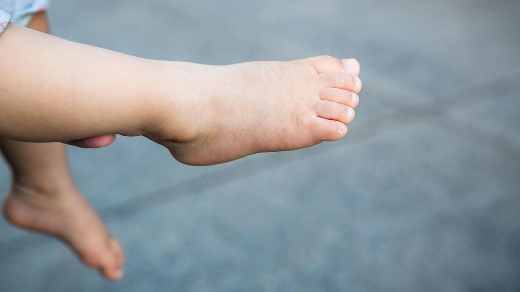 Avojaloin kulkeneella lapsella oli shortsit jalassa.