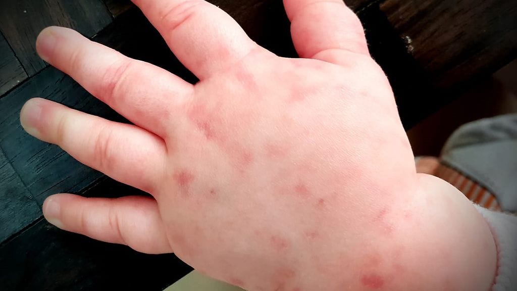 Maailman tuhkarokkotapaukset lisääntyivät myös viime vuonna jyrkästi