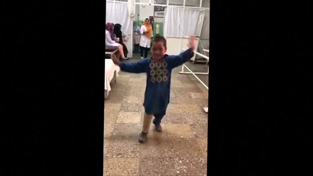 5-vuotias poika tanssi iloisesti saatuaan uuden alaraajaproteesin.