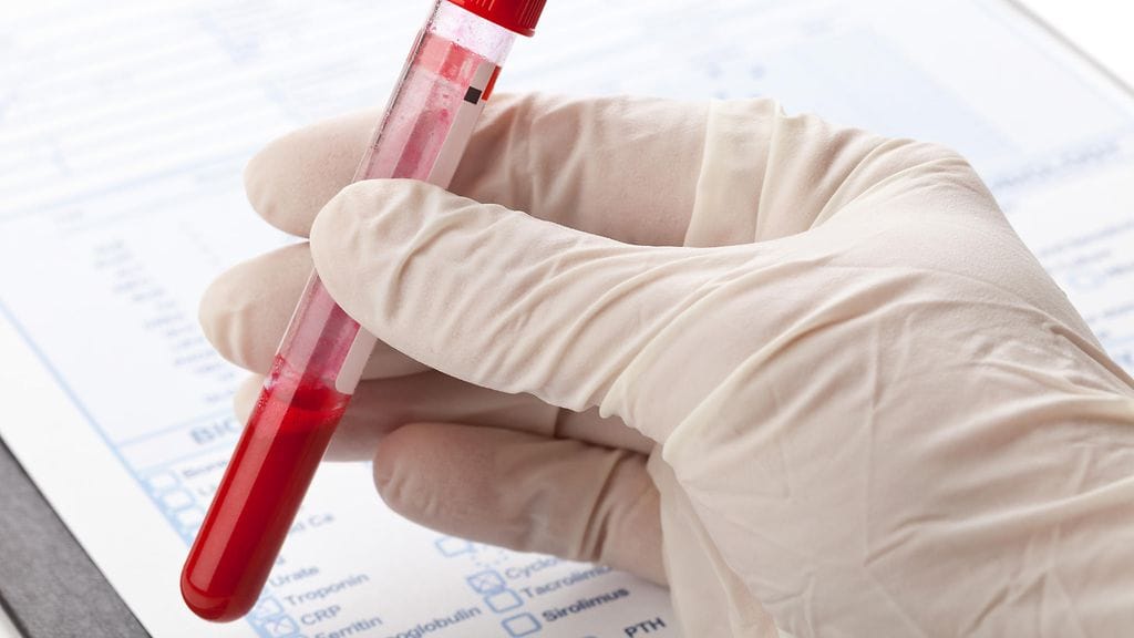 HIV-positiivisuus testataan verikokeella. Kuvituskuva.