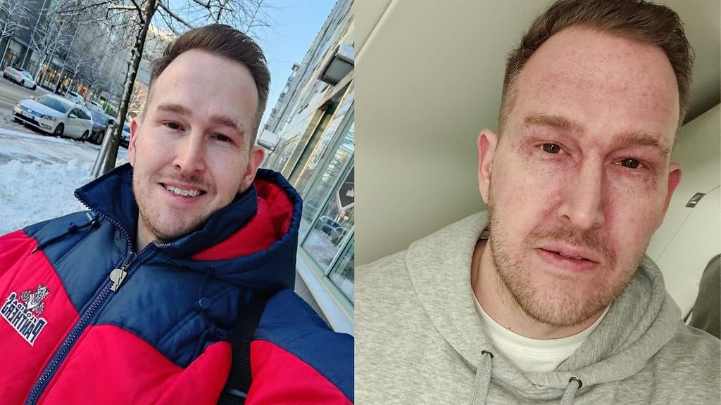 OMA: Oku Luukkainen, ennen ja jälkeen