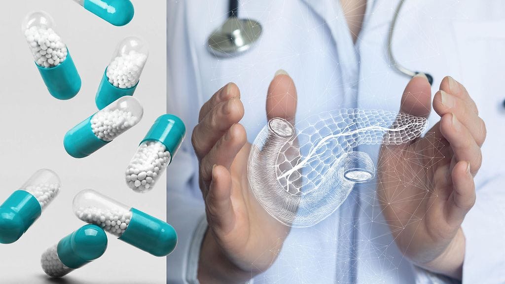 Ulosteensiirto voisi muuttaa kasvaimen mikrobikoostumusta.