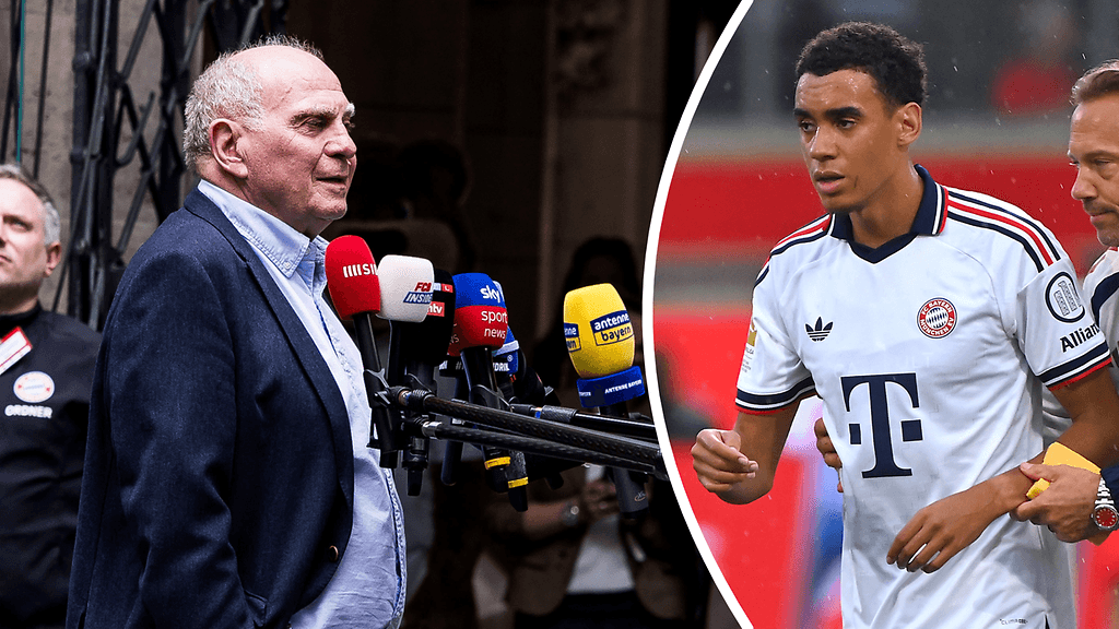 Uli Hoeness on kommentoinut Jamal Musialan terveydentilaa.